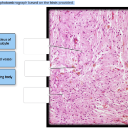 Label the photomicrograph based on the hints provided